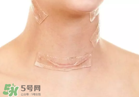 硅膠疤痕貼有用嗎？硅膠疤痕貼效果怎么樣？