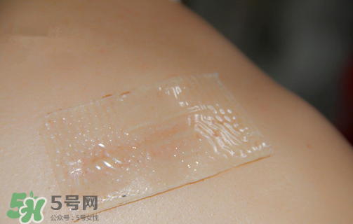 仙卡疤痕貼有用嗎？仙卡疤痕貼效果怎么樣？