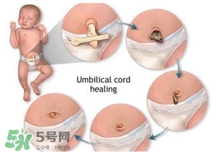 寶寶臍帶什么時候脫落？寶寶臍帶脫落后怎么護(hù)理？