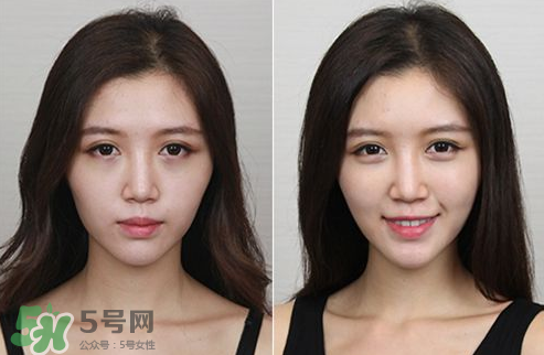 蘋果肌怎么化？蘋果肌究竟哪里好？
