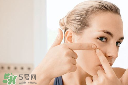 暗瘡可以擠壓?jiǎn)?？油性和骯臟肌膚會(huì)容易有暗瘡嗎？