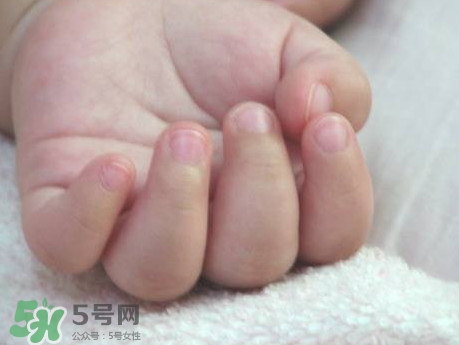 寶寶手指甲有白痕怎么回事？幼兒手指甲發(fā)白是缺鈣嗎