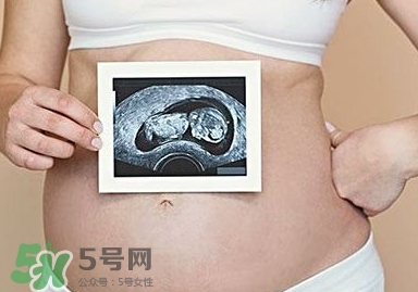 雙子宮可以上環(huán)嗎？雙子宮上環(huán)要注意哪些？