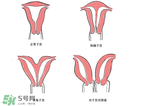 雙子宮是什么意思？雙子宮可以順產(chǎn)嗎？
