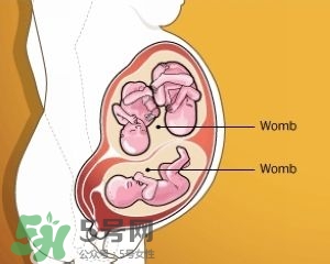 雙子宮是什么意思？雙子宮可以順產(chǎn)嗎？