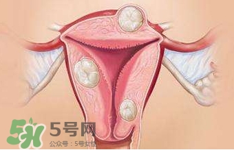 雙子宮可以上環(huán)嗎？雙子宮上環(huán)要注意哪些？