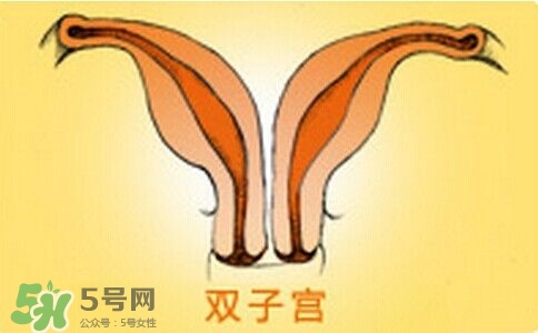 雙子宮是什么意思？雙子宮可以順產(chǎn)嗎？