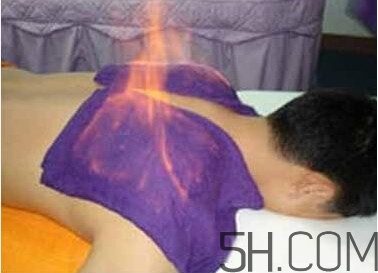 火療真的能治病嗎？火龍液的功效與作用