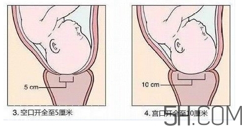 內(nèi)檢是什么感覺？內(nèi)檢有男醫(yī)生嗎？