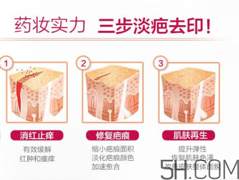 ISDIN怡思丁祛疤膏怎么用？ISDIN怡思丁祛疤膏使用說明