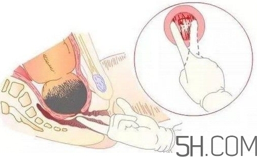內(nèi)檢是什么感覺？內(nèi)檢有男醫(yī)生嗎？