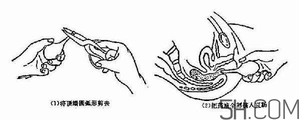 開塞露怎么用？開塞露用后多久會排便？