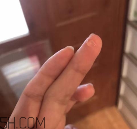 倍舒痕可以去痘印嗎？倍舒痕能涂在痘痘上嗎？