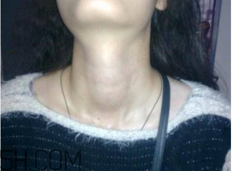 甲狀腺結(jié)節(jié)掛什么科？甲狀腺結(jié)節(jié)可以懷孕嗎