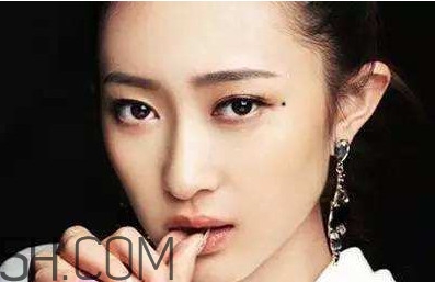 痣是怎么形成的？女人痣長哪里最有福氣