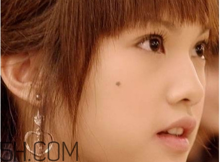痣是怎么形成的？女人痣長哪里最有福氣