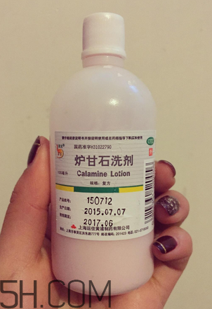 爐甘石洗劑多少錢一瓶？爐甘石洗劑治痤瘡嗎？