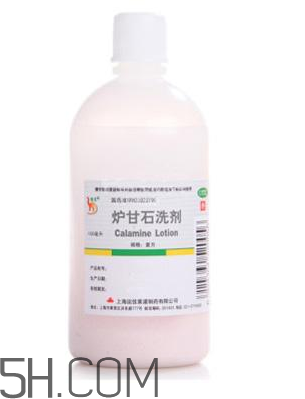 爐甘石洗劑是激素藥嗎？爐甘石洗劑是處方藥嗎？