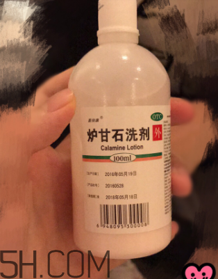 爐甘石洗劑是洗還是擦？爐甘石洗劑是什么顏色？
