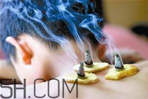 艾灸對慢性咽炎有用嗎？慢性咽炎可以通過艾灸來治療嗎？