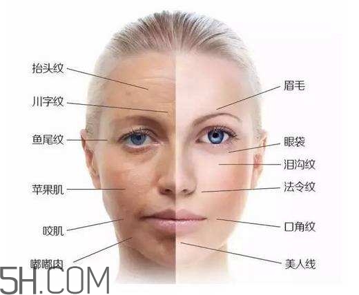 怎么預(yù)防皺紋的產(chǎn)生？導(dǎo)致皺紋的產(chǎn)生的原因有哪些？