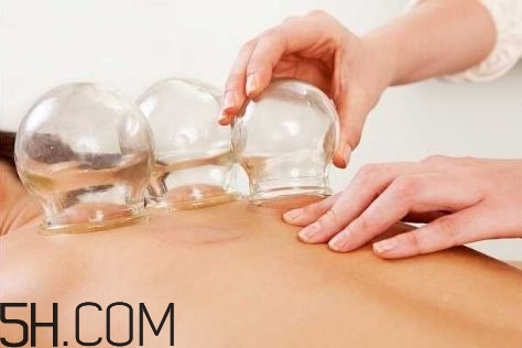 拔罐可以治療鼻炎嗎？鼻炎拔罐拔哪里？