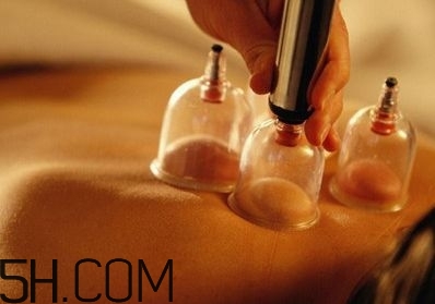 拔罐可以治療鼻炎嗎？鼻炎拔罐拔哪里？