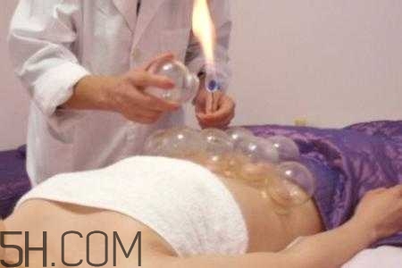 腹部拔罐可以減肥嗎？腹部拔罐拔哪個(gè)位置？