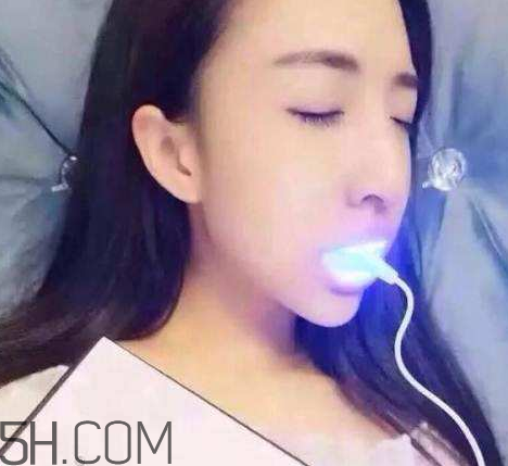 美牙儀可以兩個(gè)人用嗎？美牙儀用多久才有作用？
