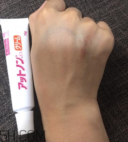 小林制藥祛疤膏有效嗎？小林制藥祛疤膏怎么樣？