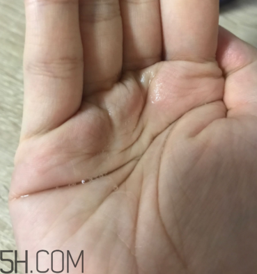雪肌精卸妝油糊眼睛嗎？雪肌精卸妝油悶痘嗎？