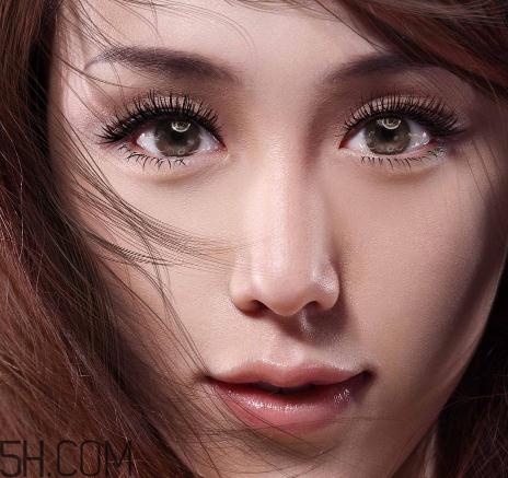 上瞼提肌手術有必要嗎？上瞼提肌后是永久的嗎？