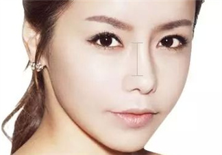 達(dá)拉斯隆鼻是什么材料？達(dá)拉斯隆鼻怎么樣？