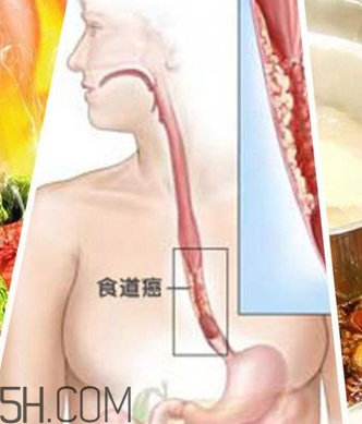吃太燙會得癌？燙食不僅對胃不好還容易得癌