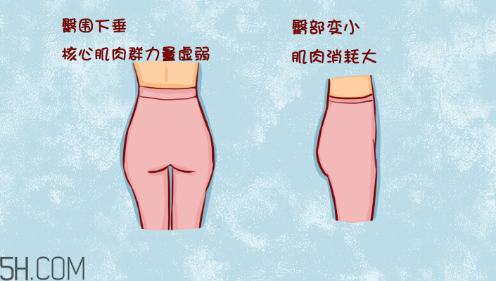 臀部護(hù)理對(duì)健康有什么影響？日常如何保養(yǎng)臀部健康？