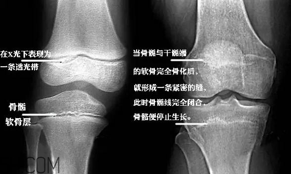 孩子學(xué)街舞好不好？學(xué)街舞好處多多
