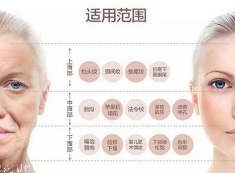 大v線會(huì)斷嗎？一定要選擇正規(guī)整形醫(yī)院