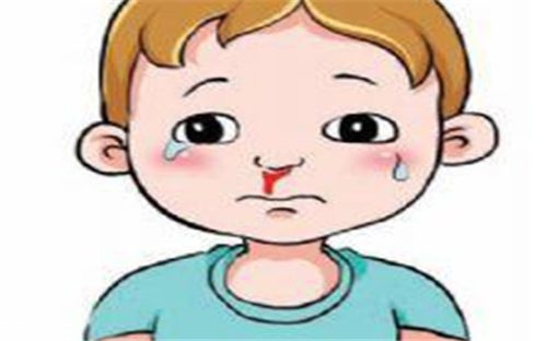 兒童流鼻血有何危害？治療要及時(shí)