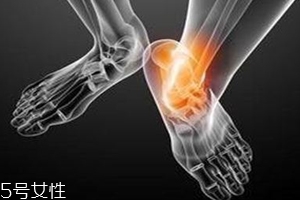 痛風跟飲食有關？痛風更多與遺傳有關