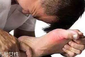 痛風(fēng)可以治愈嗎？無法治愈但能控制