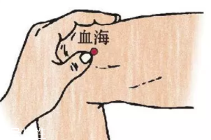濕疹怎么治才管用？?jī)?nèi)外同治是關(guān)鍵