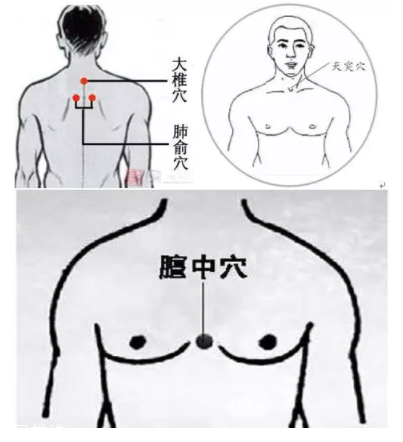 吮痧有什么療效？最溫柔的治病方法
