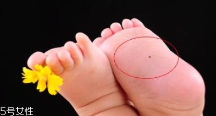 痣什么情況下會(huì)轉(zhuǎn)變?yōu)榱?？點(diǎn)痣不可取