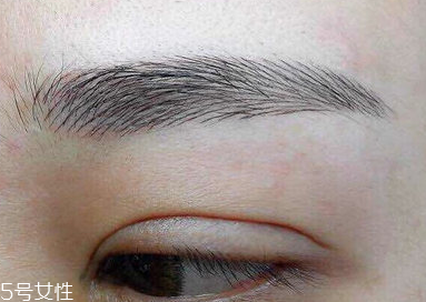激光洗眉恢復(fù)期有疤痕怎么辦？激光洗眉毛之后正確護(hù)理方法