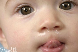 冬季寶寶流鼻涕是什么原因？教你幾招輕松應對