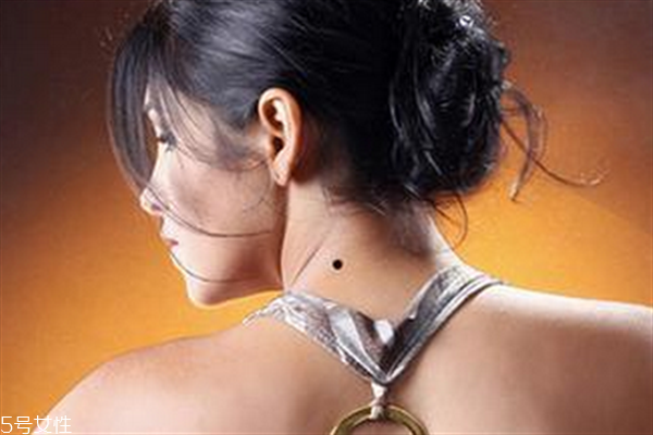 脖子后面有痣代表什么？10大身體缺陷是好事