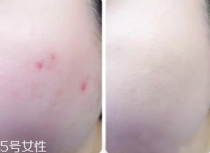 cpb遮瑕棒怎么樣？來(lái)看看使用效果