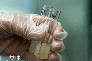 捐精有什么危害？專家稱沒(méi)有危害