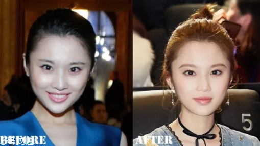 瑯琊榜2張慧雯整容了嗎？換了妝發(fā)美到不認(rèn)識