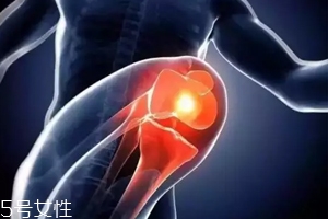 關(guān)節(jié)有響聲是病嗎？?jī)煞N情況區(qū)別對(duì)待